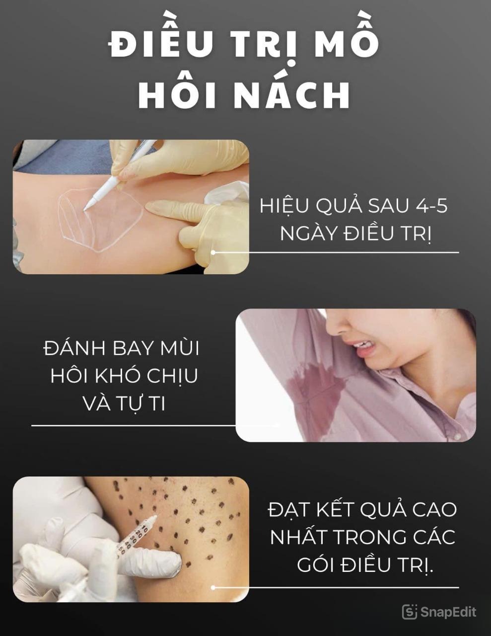 Tiêm Botox Nách Xong Có Ra Mồ Hôi Nữa Không?